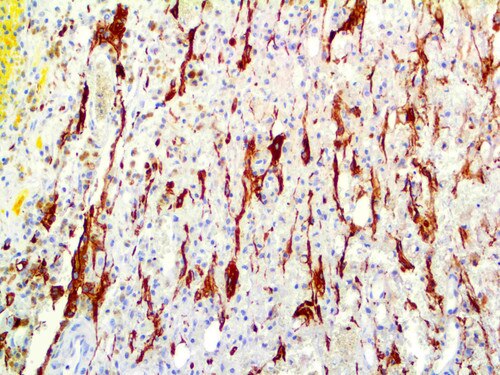 IHC of GFAP RMab on an FFPE Brain Tissue